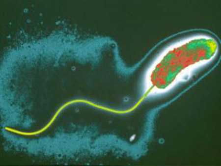 Холера и холерный вибрион