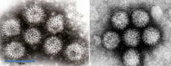 Все о ротавирусной инфекции